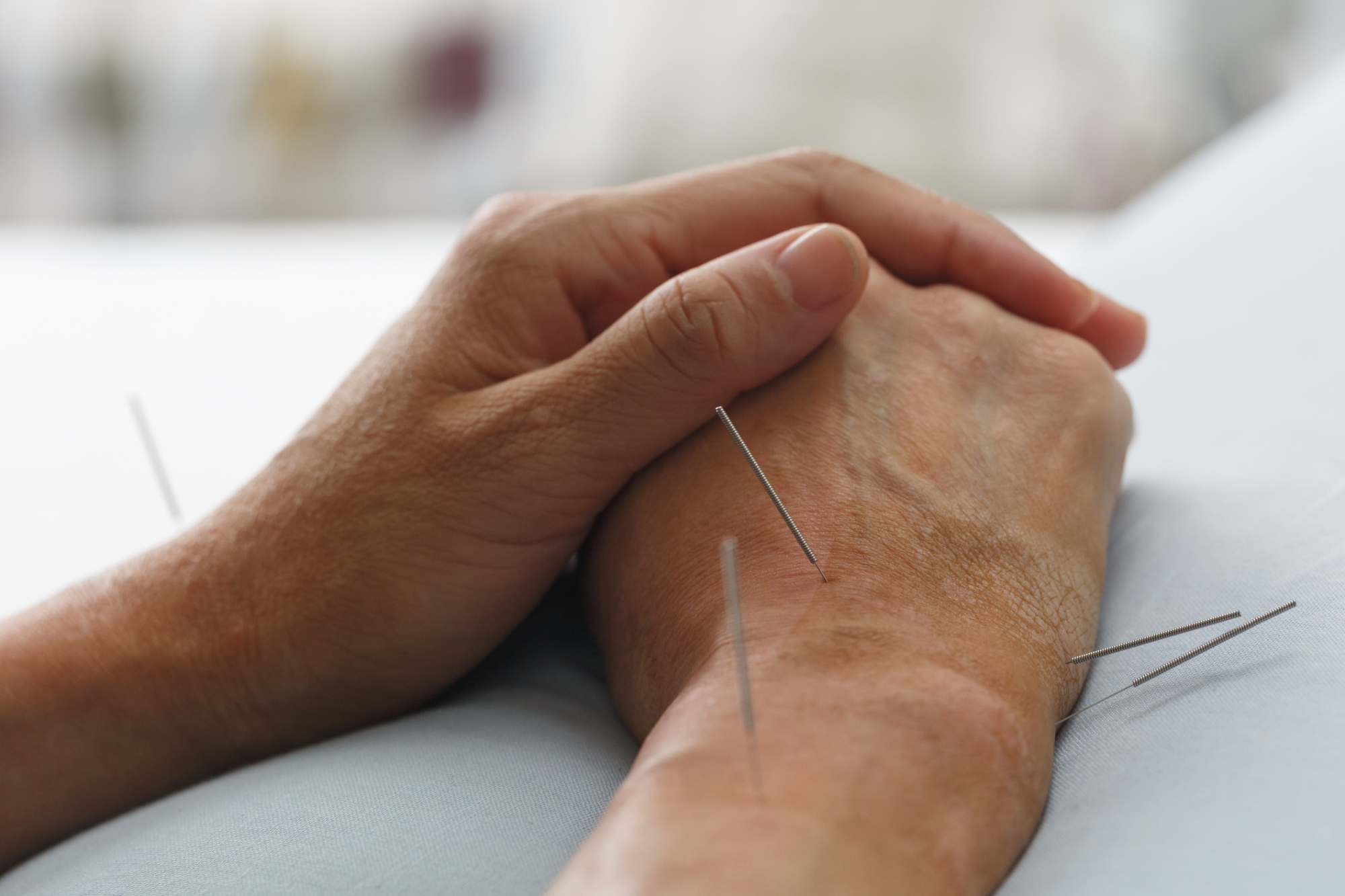 does medicare cover acupuncture